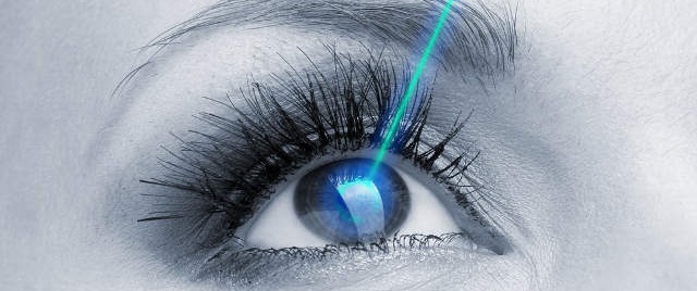 Лазерная коррекция зрения (ЛАСИК)