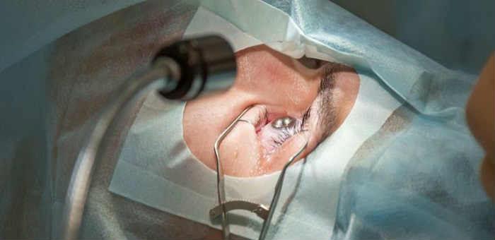 Близорукость (миопия) - лазерное лечение (операция)