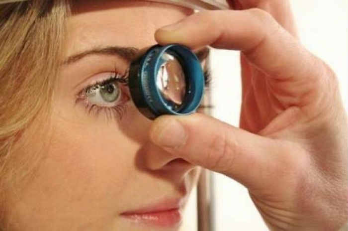 Закрытоугольная глаукома - лечение
