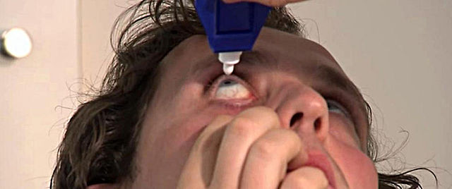 Лечение эписклерита глаз