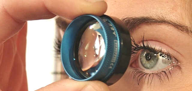 Лечение вывиха (подвывиха) хрусталика глаза