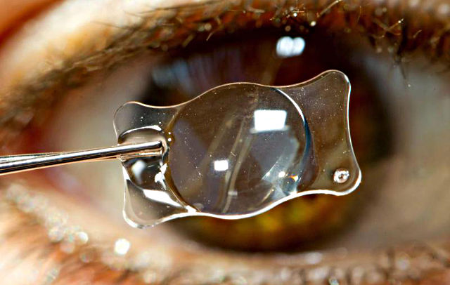 Лучшие искусственные хрусталики при катаракте