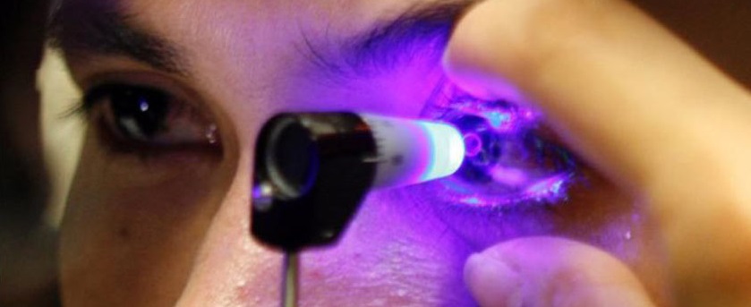 ИнтраЛАСИК операция лазерной коррекции зрения