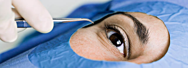 Удаление пингвекулы глаза - операция