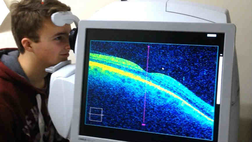 Оптическая когерентная томография глаза