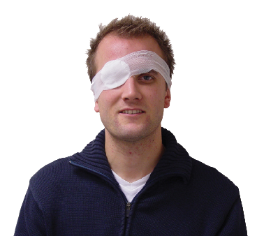 После операции по удалению катаракты глаза (памятка)