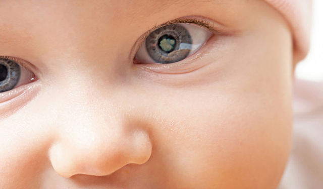 катаракта у детей причины 