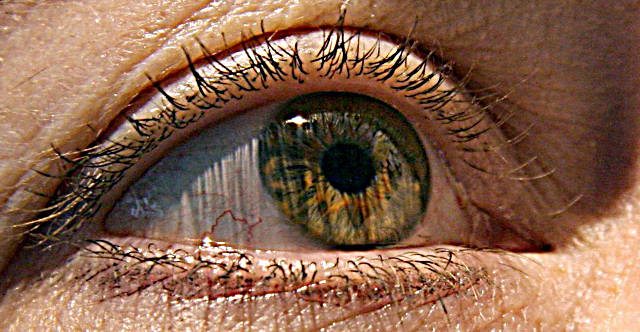 Заболевания роговицы глаза человека