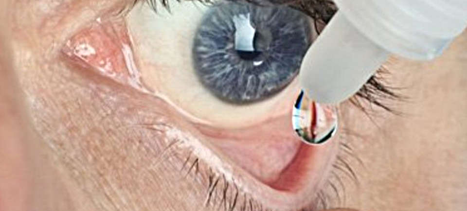 Ланостерол - капли для глаз от катаракты
