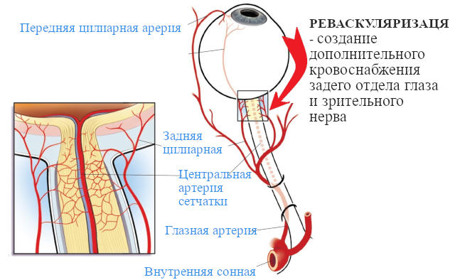Лечение атрофии зрительного нерва (ЧАЗН) в Москве