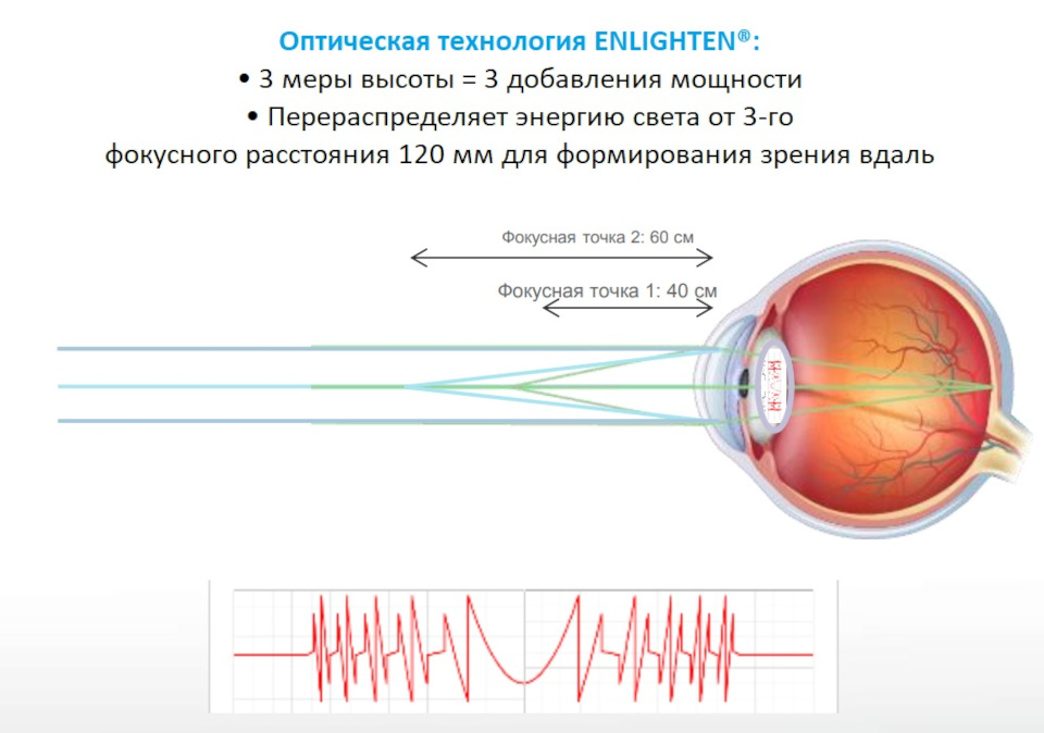 Схематическое изображение технологии ENLIGHTEN и дифракционной решётки линзы