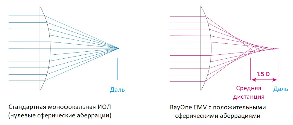 Сравнение монофокальной ИОЛ и Rayner RayOne EMV