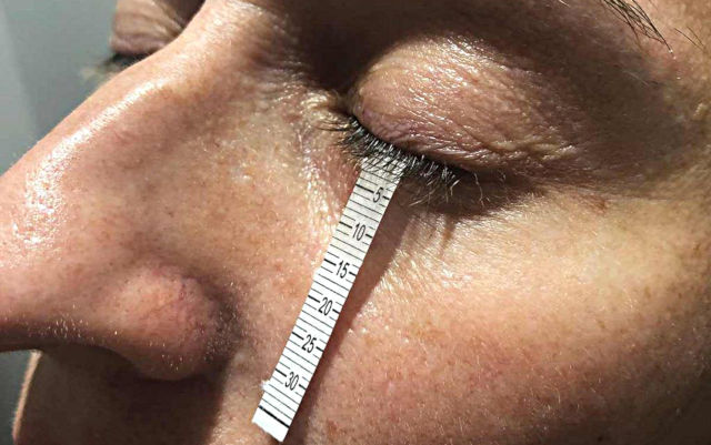 Диагностика и лечение сухого глаза в Москве - тес Ширмера на слезопродукцию